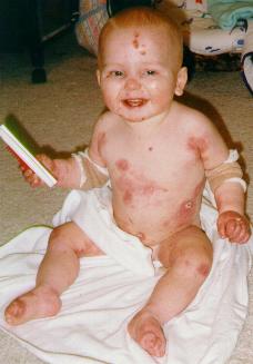 Nicky at 10 months old. The damage to his body is already quite evident.