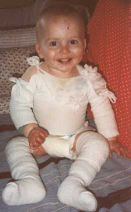 Photo: Nicky with all his padding. Here he was 19 months old
